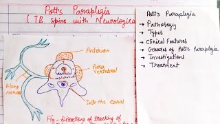 Potts Paraplegia Part1  TB spine with Neurological involvement [upl. by Einaffit]