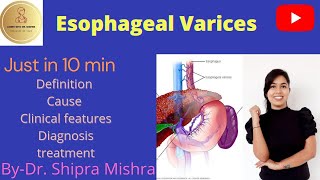 Esophageal Varices in HindiCause Symptoms Diagnosis Treatment Dr Shipra Mishra [upl. by Casabonne]