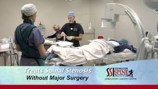 Mild Procedure at Southeastern Spine Instutitute [upl. by Musa]