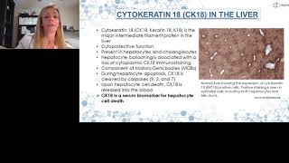 CK18 as a Biomarker in NASH Clinical Trials [upl. by Pen]