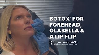 Lip Flip With Botox [upl. by Nibas]