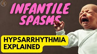 The Terrifying Truth About Infantile Spasms [upl. by Leanahtan]