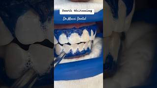 Office Teeth Whiteningzoom teethwhitening music song dance pop viral dentist satisfying f [upl. by Rimidalb]