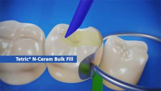 Bluephase  Tetric N Ceram Bulk Fill [upl. by Yebloc]