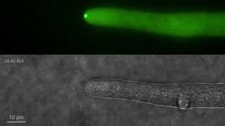 Spitzenkörper in filamentous fungus Neurospora crassa [upl. by Yedorb]