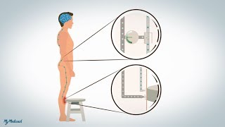 Neuropatische en disfunctionele pijn [upl. by Yerfej]