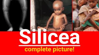 Silicea homeopathic medicine  Silicea complete picture  In which potency silicea is used for boil [upl. by Loise]