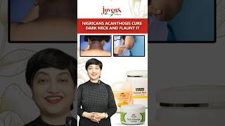 Nigricans Acanthosis Cure Dark Neck And Flaunt It  Juvena Herbals [upl. by Marashio]