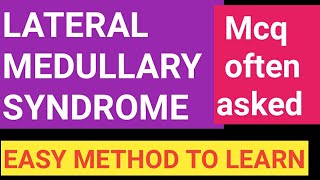 Lateral Medullary syndrome  MCQ amp mneumonic [upl. by Readus]