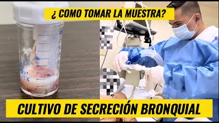 Como tomar un cultivo de secrecion bronquial [upl. by Niple]