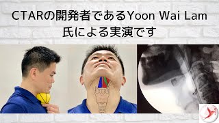 Japanese Dysphagia Swallowing Exercise  Chin Tuck Against Resistance with Ball by CTAR Inventor [upl. by Feerahs720]