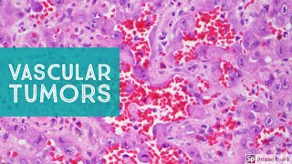 Vascular Tumors of the Skin  Explained by a Soft Tissue Pathologist [upl. by Acinomaj]