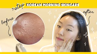 💦 Korean Skincare Routine for Fungal Acne Oily Skin bumpy TO GLASS skin 韓国人みたいな肌になる化粧品紹介 [upl. by Ardle]