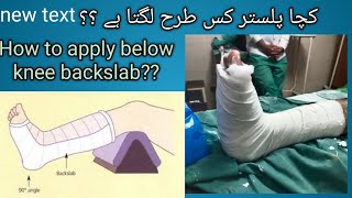 How to apply below knee backslab kacha plaster kis tarah lgta hapopcast [upl. by Barbette7]