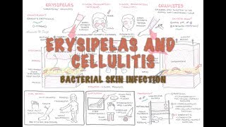 Bacterial Skin Infection  Cellulitis and Erysipelas Clinical Presentation Pathology Treatment [upl. by Aenit]