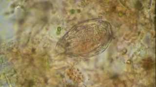 Rotifer under the microscope [upl. by Ahserb282]