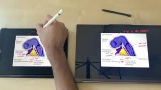 Lenovo Yoga C940 vs iPad Pro Notetaking  Windows 10 vs iPadOS [upl. by Guildroy]