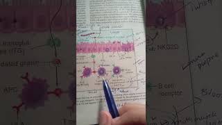 Pathogenesis of Celiac Disease  Robbin  Pathology [upl. by Akemihs]