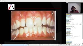 Periodontics  Gingiva and Tooth Supporting Structure [upl. by Cahn]