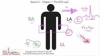 Basics of ECG Leads 51  ECG  EKG Interpretation  BASIC [upl. by Anitaf]