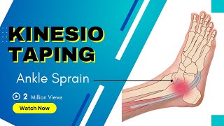 How to treat an Ankle Inversion Sprain  Kinesiology Taping to stabilise ligaments [upl. by Kciredes241]