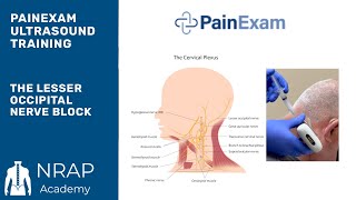 The Ultrasound Guided Lesser Occipital Nerve Block NRAP Academys Ultrasound Course excerpt [upl. by Tail]