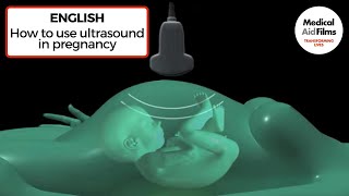 How to use ultrasound in pregnancy [upl. by Lukas]