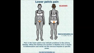 9 Types Of Referred Pain You Should Know [upl. by Letsyrk]