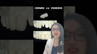 VENEERS vs CROWNS  Dr Bianca Beley  Short 2 [upl. by Stormy]