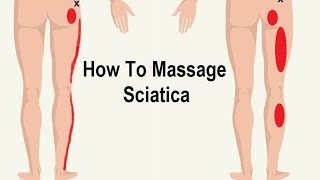 How To Reduce Sciatica Pain with Massage Trigger Point [upl. by Frendel]