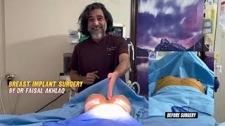 BREAST IMPLANT  BREAST AUGMENTATION SURGERY [upl. by Fraya]