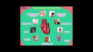 Aortitis Symptoms and Causes  Diagnosis  Treatment  Prevention healthcare [upl. by Nylrehs506]