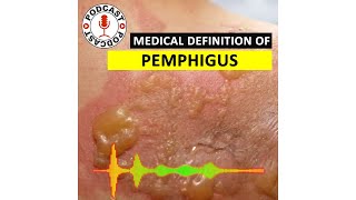 Pemphigus Medical Definition of Pemphigus HaileyHailey disease Podcast [upl. by Montana]