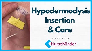 Hypodermoclysis Insertion and Care for Nurses [upl. by Ahsinut108]