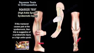 Squeeze Test In Orthopaedics  Everything You Need To Know  Dr Nabil Ebraheim [upl. by Wilt]