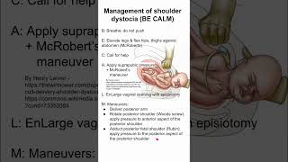 Management of shoulder dystocia BE CALM [upl. by Emirak]