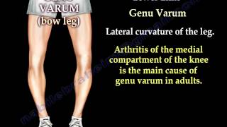 Alignment Of The Lower Limb  Everything You Need To Know  Dr Nabil Ebraheim [upl. by Ronoc]