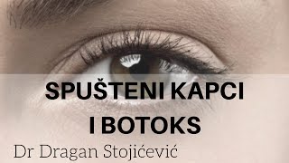 Botoks i spušteni kapci [upl. by Eberto]