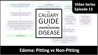 Edema Pitting vs Nonpitting [upl. by Roshelle42]