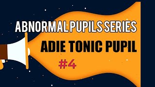 ADIE TONIC PUPIL  DIAGNOSIS AND TREATMENT OF ADIE TONIC PUPIL  Abnormal pupil series  4 [upl. by Leahkim224]