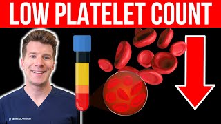 Doctor explains LOW PLATELET COUNT Thrombocytopenia  Causes symptoms and more [upl. by Suoivatnod]