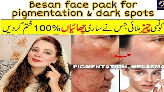 Besan Face pack for pigmentation and dark spots  How to get rid of hyperpigmentation on black skin [upl. by Fai]