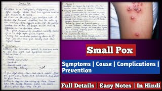 Small Pox  Small Pox  symptoms causes complications and prevention [upl. by Ilenay]