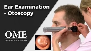 Otoscopy Ear Examination  ENT [upl. by Grange]