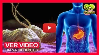 ¿Helicobacter Pylori Tratamiento Natural Para La Bacteria H Pylori En Adultos Te Digo Como Se Cura [upl. by Minta]