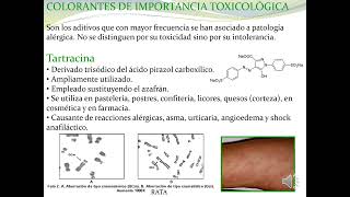 22 2 Toxicología de los alimentos [upl. by Otrebogir]