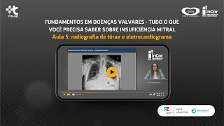 Aula 5  Tudo o que você precisa saber sobre insuficiência mitral radiografia de tórax e ECG [upl. by Mel]