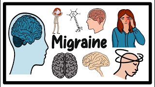 Migraine Headache Causes Symptoms amp Treatment Guide [upl. by Bobina]