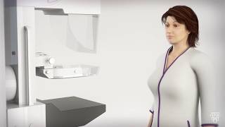 Mammogram for Breast Cancer  What to Expect [upl. by Albur]