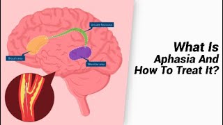 What Is Aphasia And How To Treat It [upl. by Hcone]